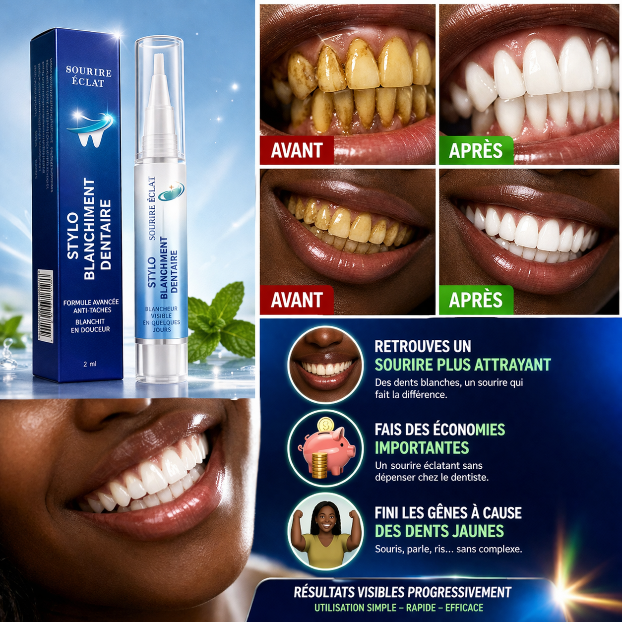 Stylo de blanchiment dentaire