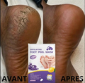 Masque de pied - Nettoie,Hydrate,répare (1 acheté=1 offert GRATUITEMENT)